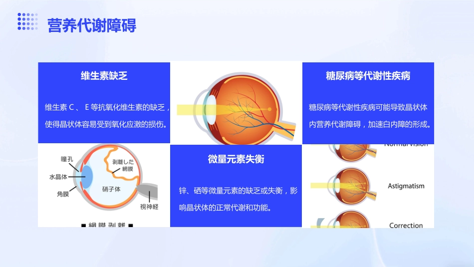 《老年性白内障》_第10页