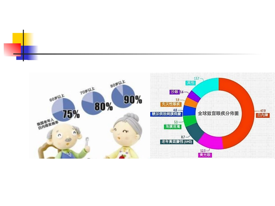 白内障超声乳化摘_第2页