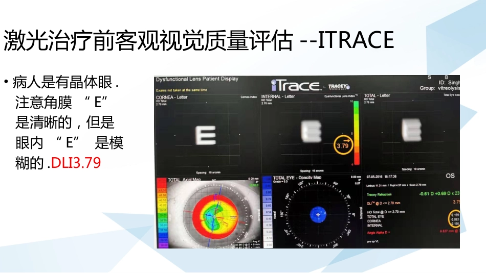 玻璃体混浊的激光消融治疗_第11页