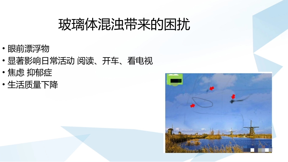 玻璃体混浊的激光消融治疗_第4页