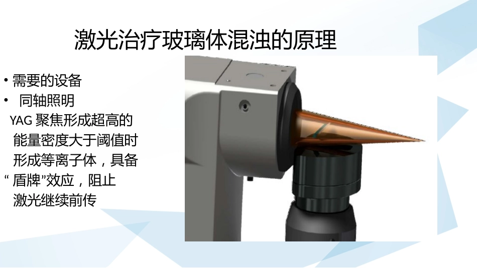 玻璃体混浊的激光消融治疗_第7页