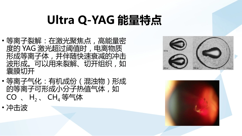 玻璃体混浊的激光消融治疗_第8页