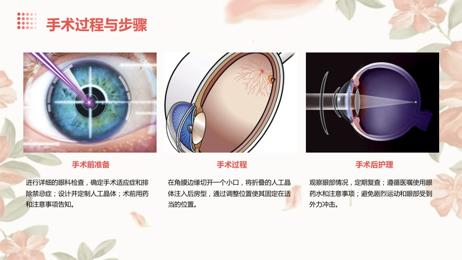 ICL有晶体眼后房型人工晶体植入矫正高度近视_第5页