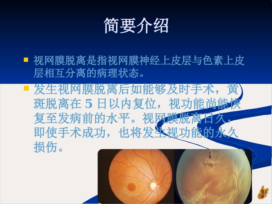 玻璃体切除病人查房_第4页