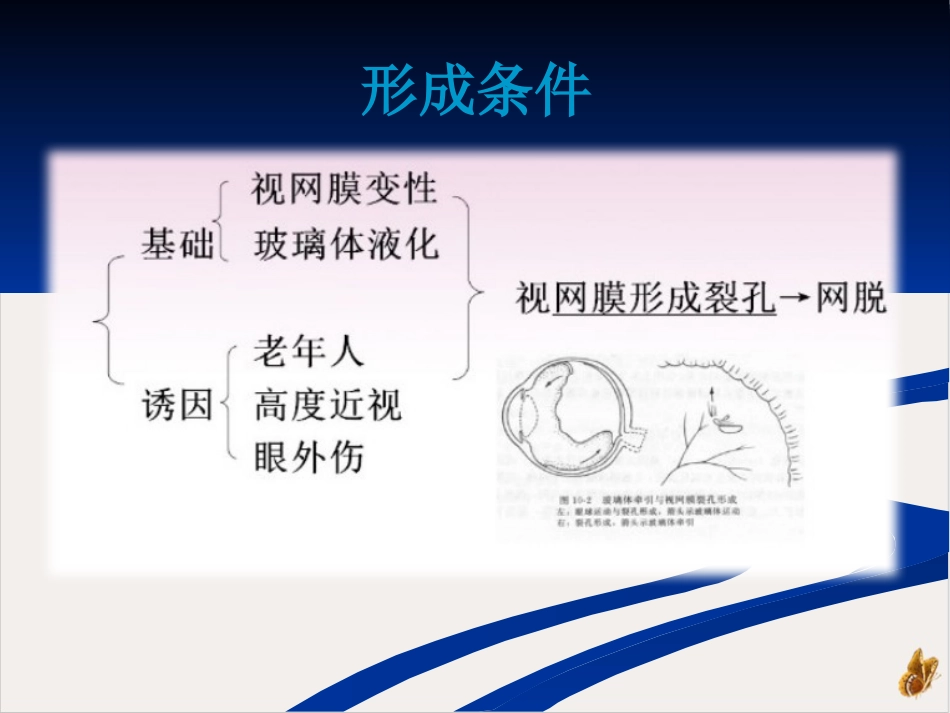 玻璃体切除病人查房_第5页