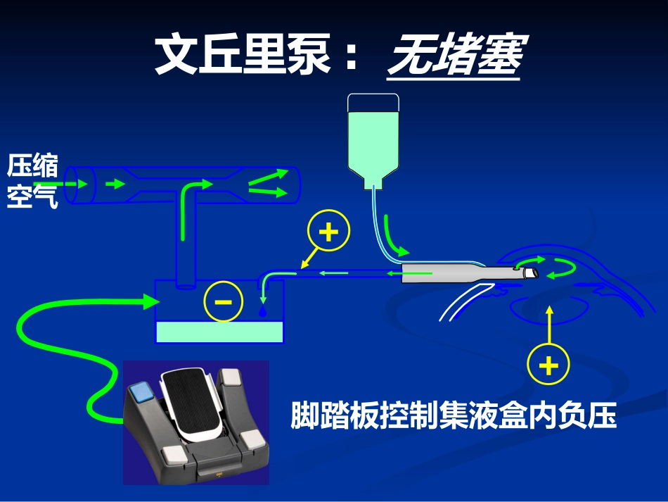 白内障超声乳化及其并发症_第12页