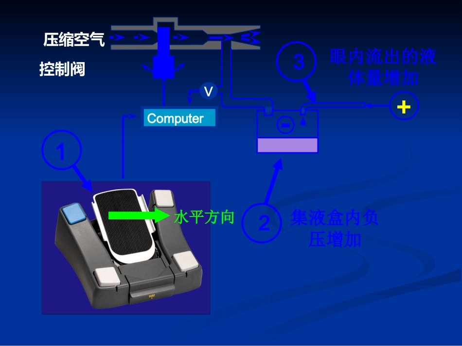 白内障超声乳化及其并发症_第13页