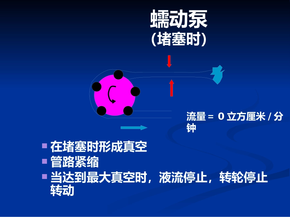 白内障超声乳化及其并发症_第8页