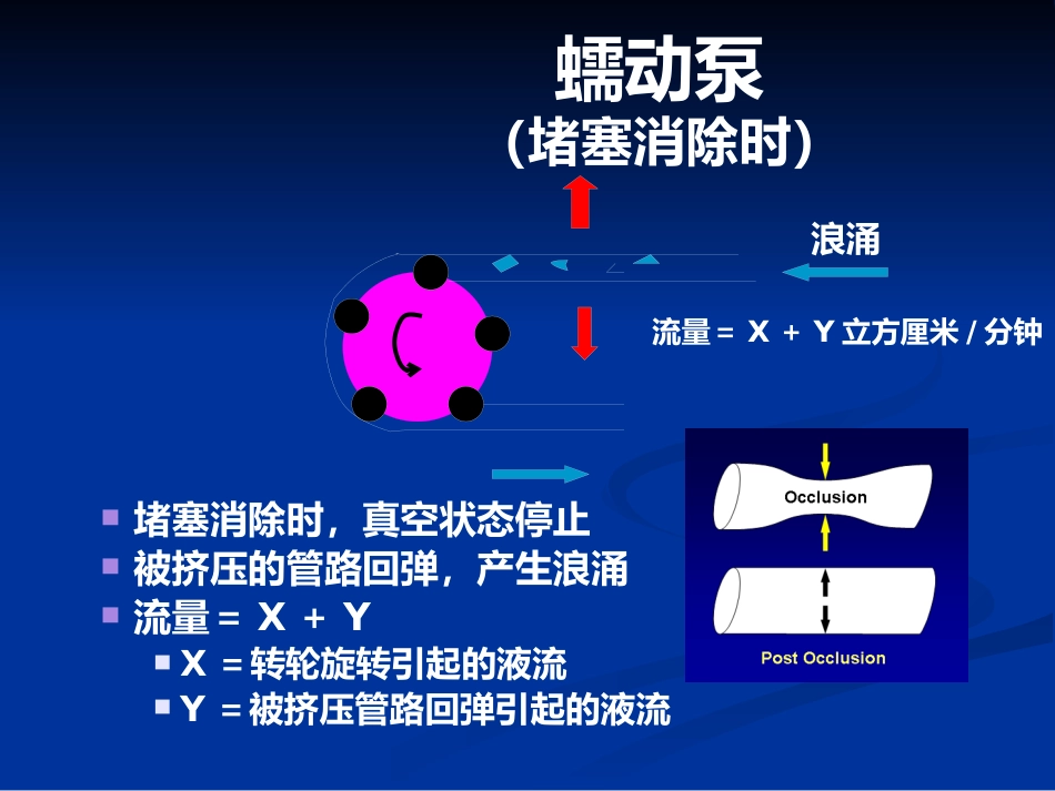 白内障超声乳化及其并发症_第9页