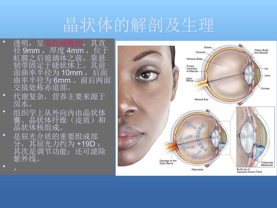 白内障的治疗讲解ppt_第2页