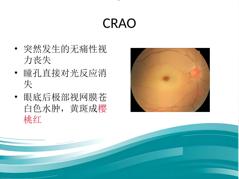 玻璃体和视网膜疾病_第12页