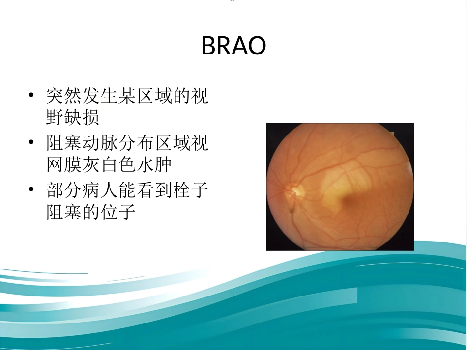 玻璃体和视网膜疾病_第13页