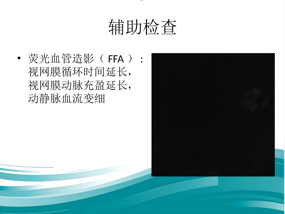 玻璃体和视网膜疾病_第14页