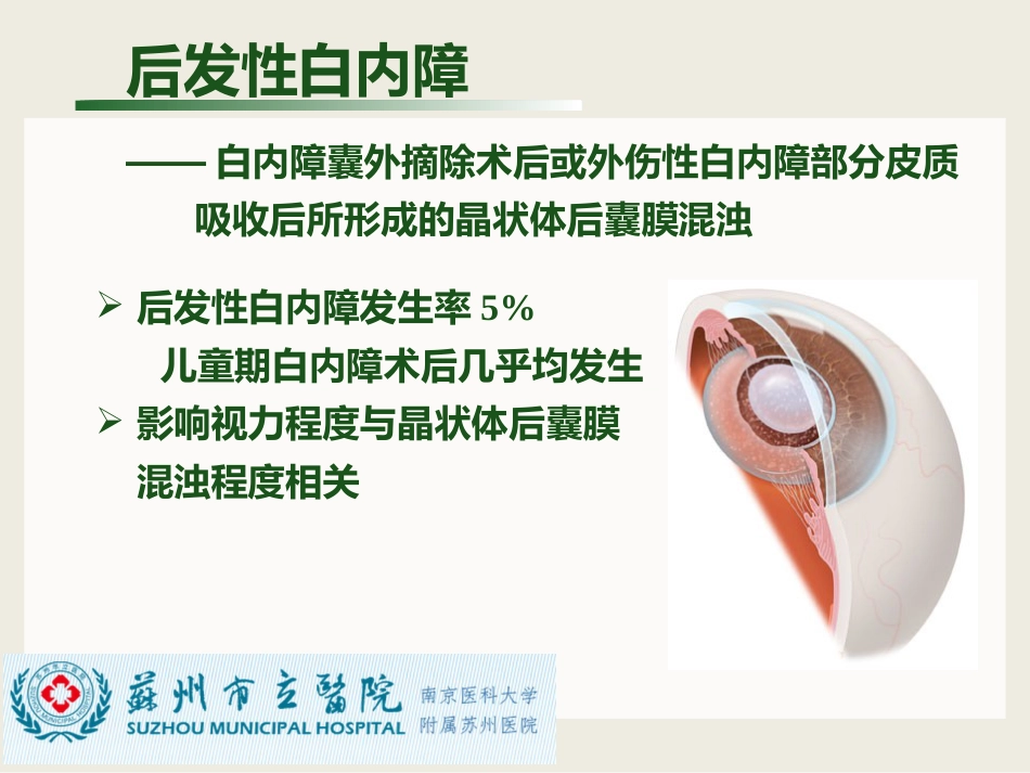 白内障与青光眼与胬肉与糖网_第9页