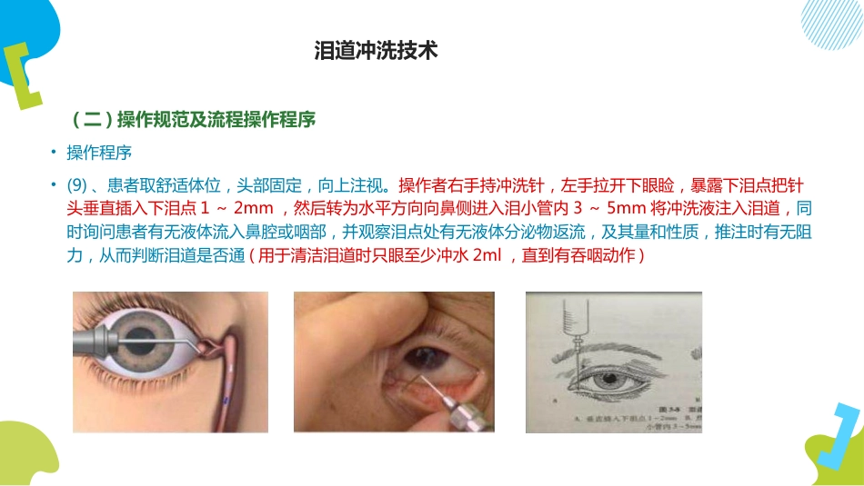 泪道冲洗技术ppt_第4页