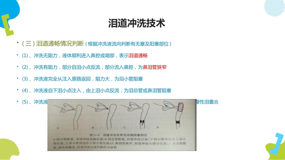 泪道冲洗技术ppt_第6页