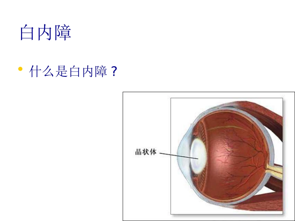 白内障玻璃体混浊_第2页