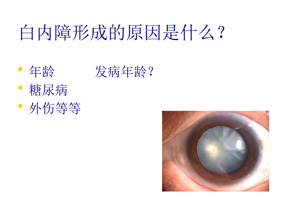 白内障玻璃体混浊_第4页