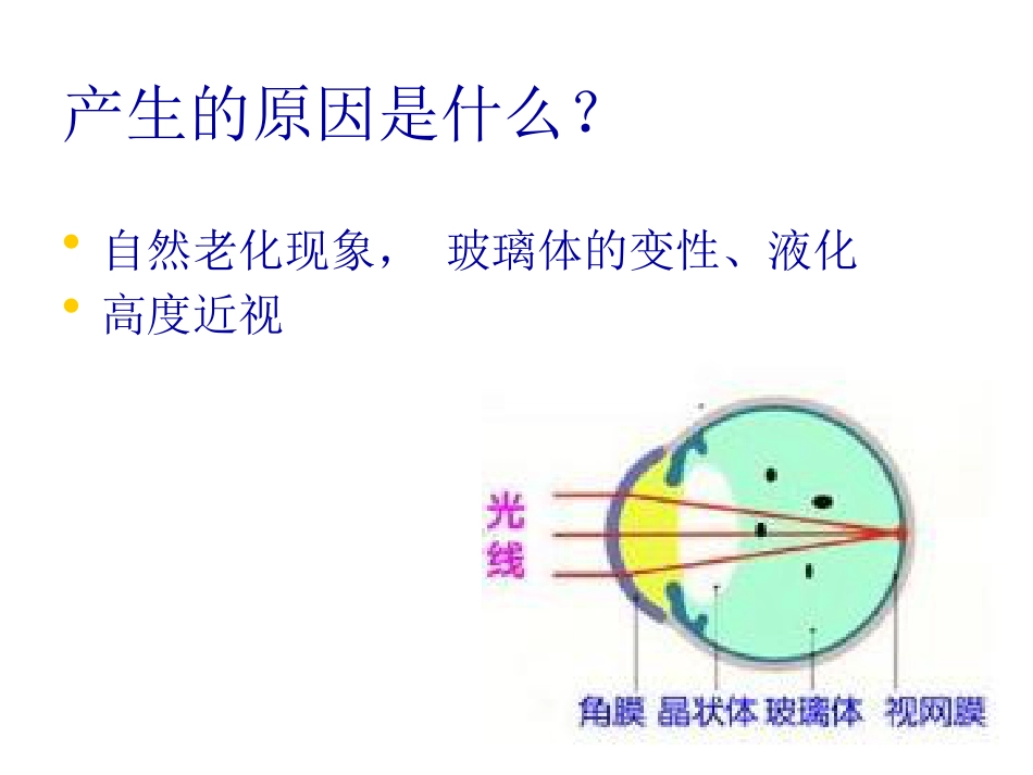 白内障玻璃体混浊_第8页