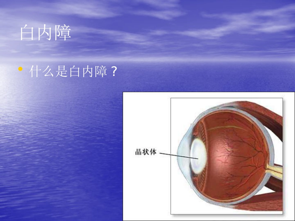 白内障 玻璃体混浊_第2页