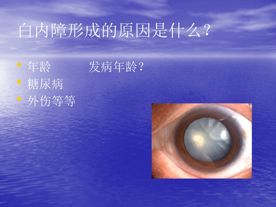 白内障 玻璃体混浊_第4页