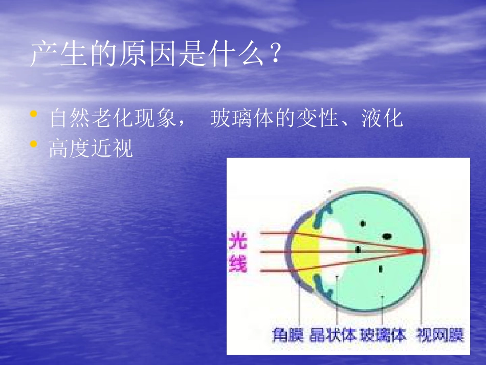 白内障 玻璃体混浊_第8页