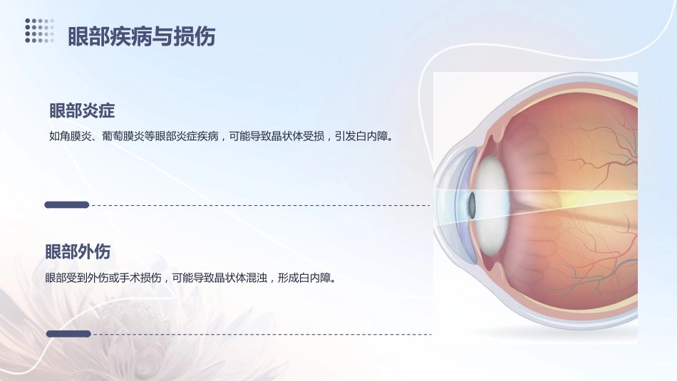 白内障科普_第10页