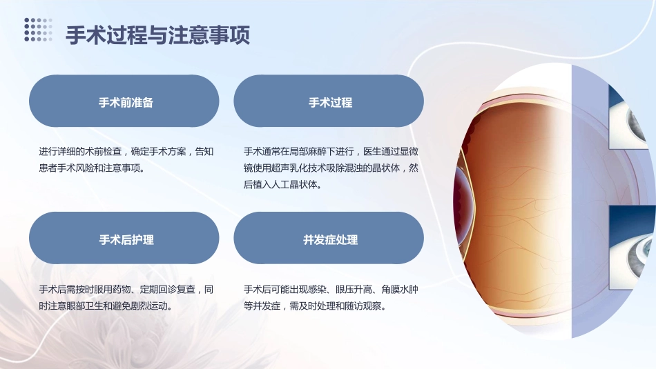 白内障科普_第15页