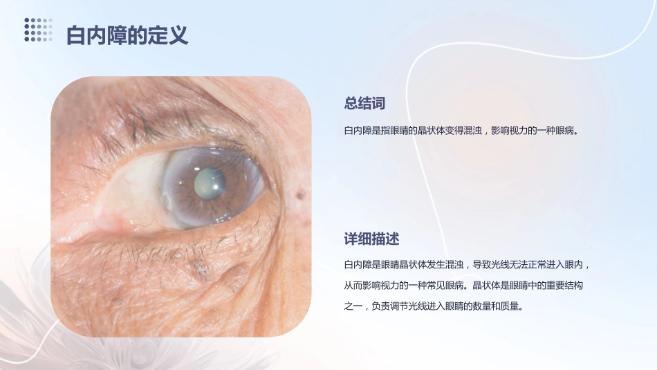 白内障科普_第4页