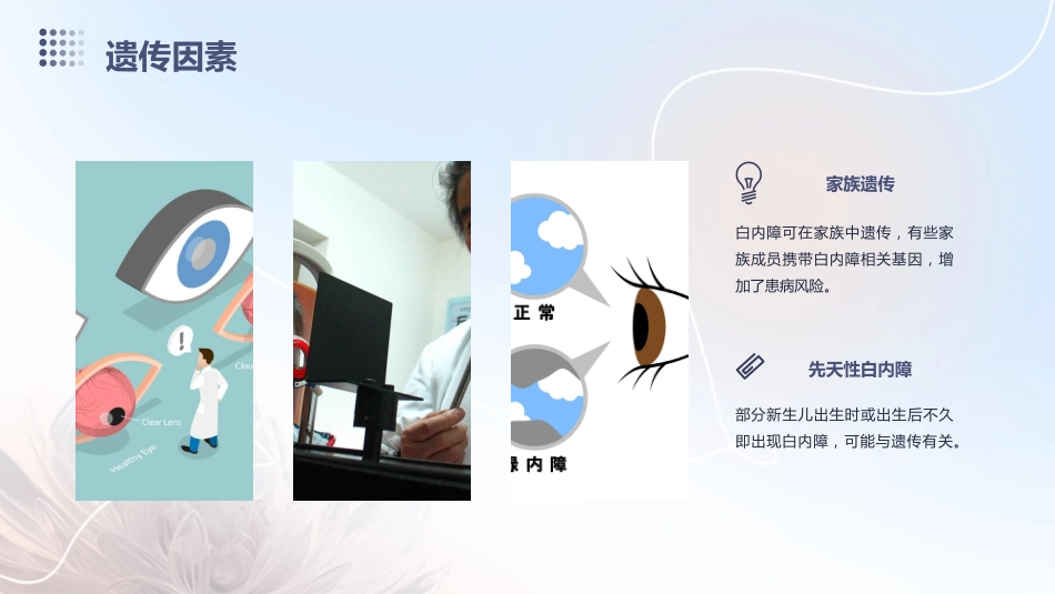 白内障科普_第8页