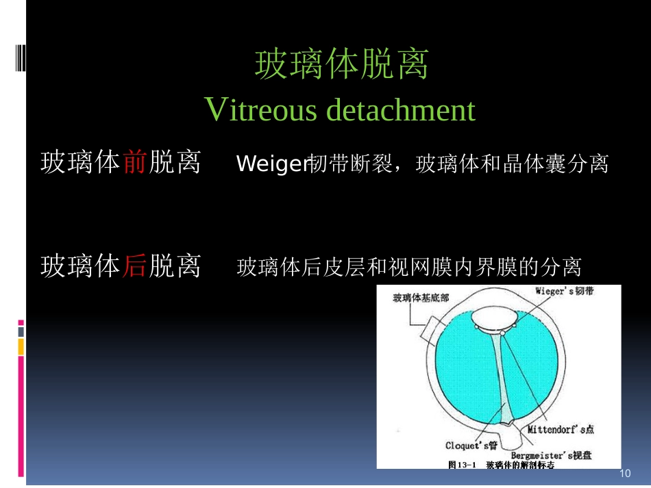 玻璃体病_第10页