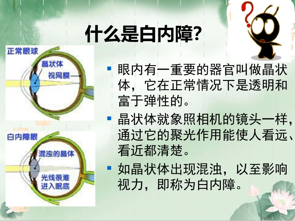 白内障科普讲座_第3页