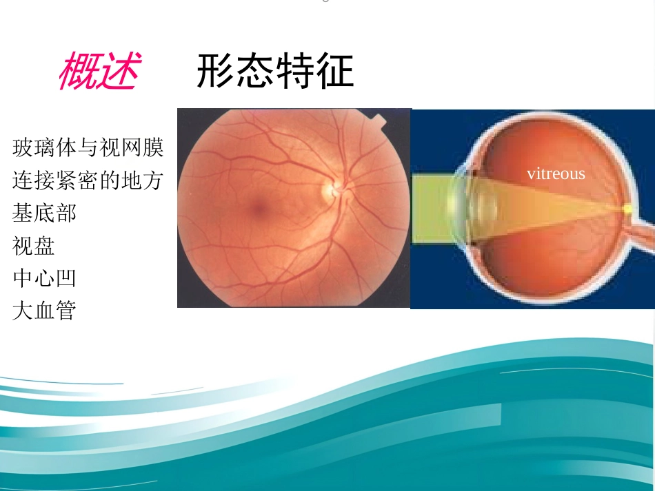 玻璃体-视网膜病-医学课件_第6页
