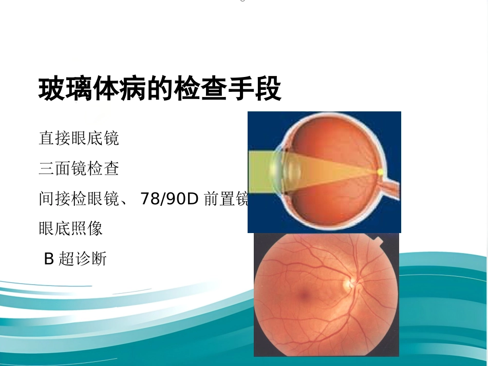 玻璃体-视网膜病-医学课件_第9页