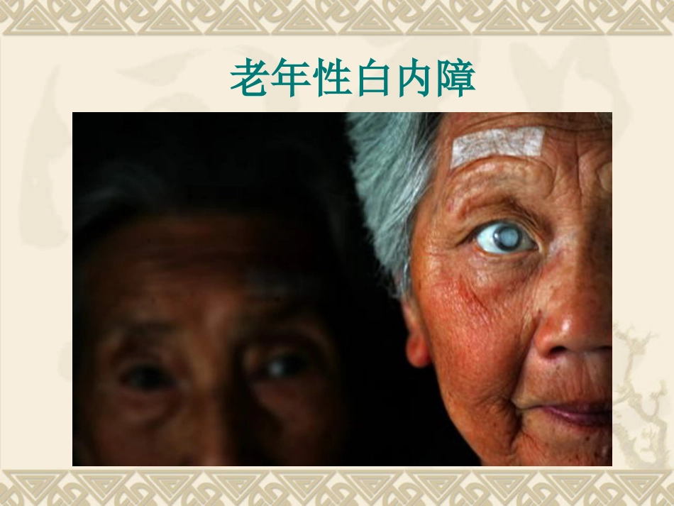 白内障患者护理_第12页