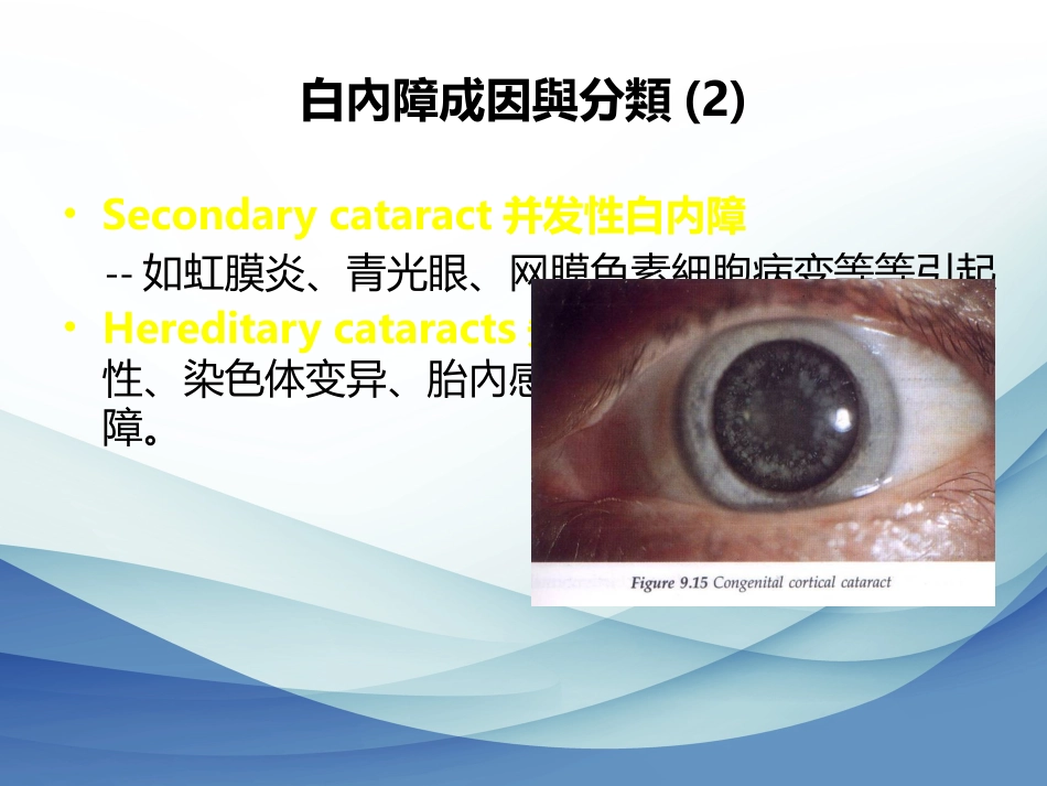 白内障成因及治疗_第11页