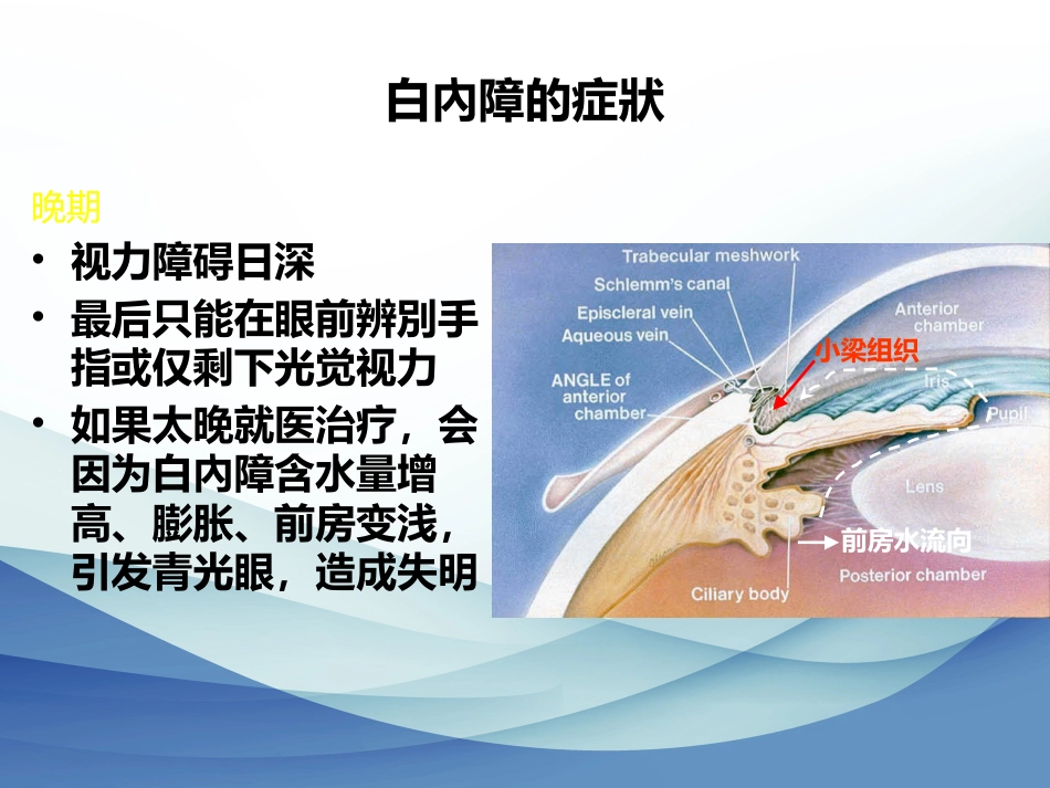 白内障成因及治疗_第13页
