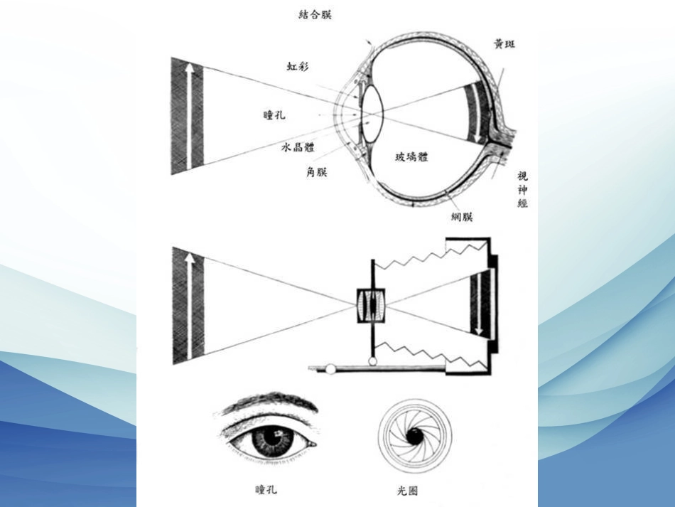 白内障成因及治疗_第3页