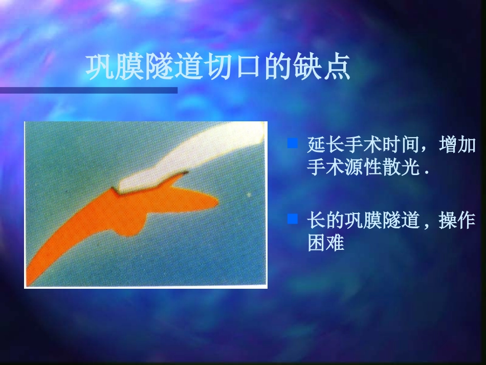 白内障超声乳化摘出术_第13页