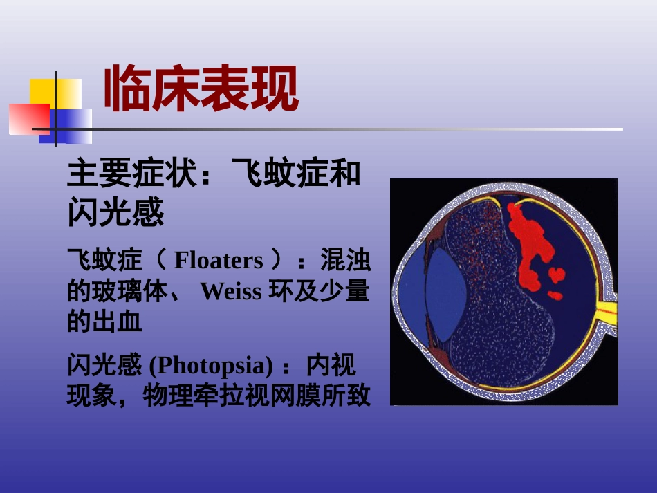 玻璃体后脱离、视网膜裂孔和格子样变性的诊断和治疗_第10页