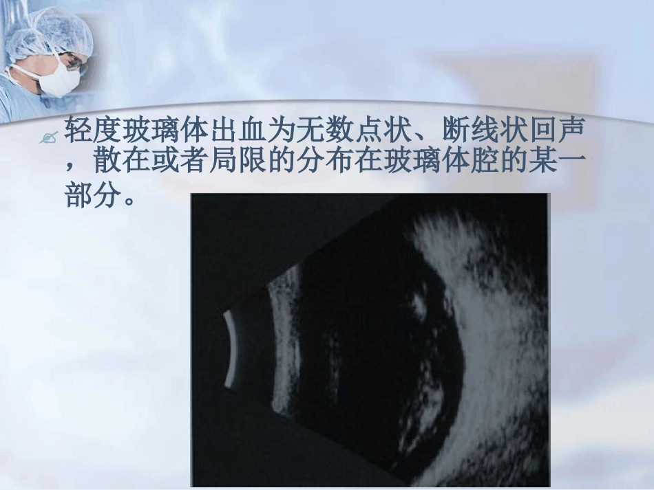 玻璃体积血_第5页