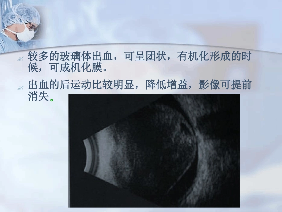 玻璃体积血_第6页