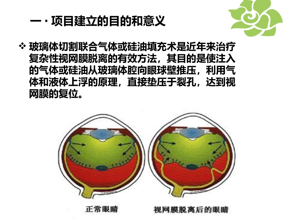 玻璃体切割术后_第4页
