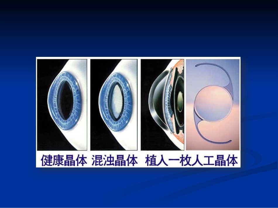 常见眼病_第10页