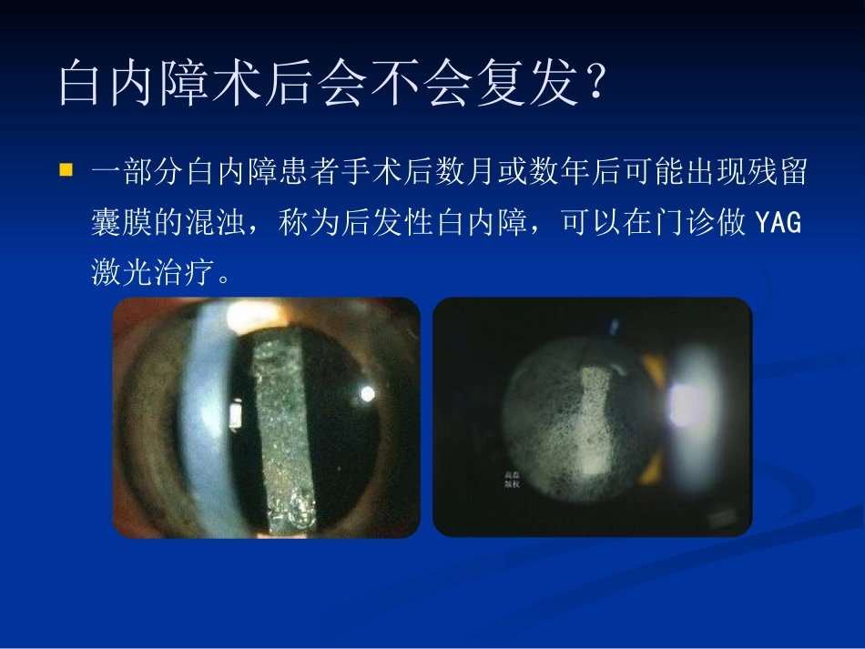 常见眼病_第13页