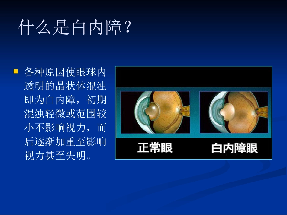 常见眼病_第2页