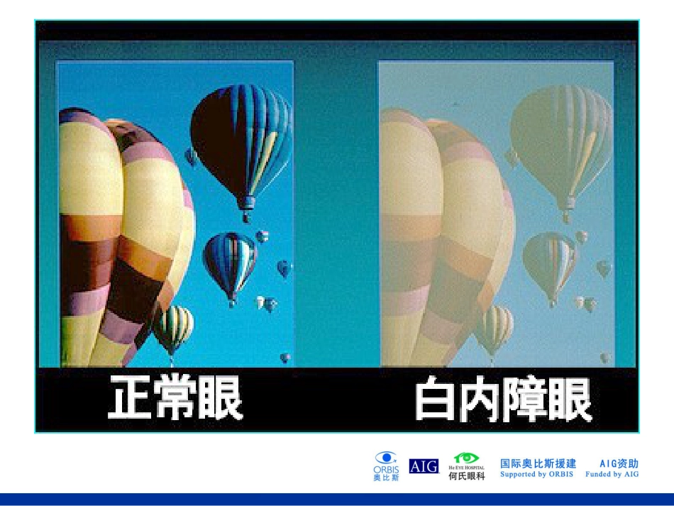 常见眼病_第3页