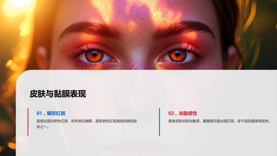 系统性红斑狼疮教学ppt课件_第13页