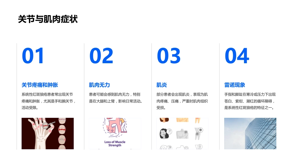 系统性红斑狼疮教学ppt课件_第14页