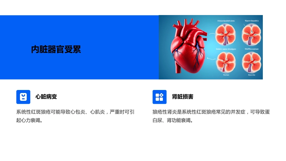 系统性红斑狼疮教学ppt课件_第15页